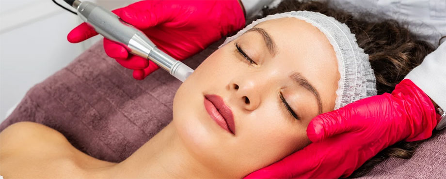 Microneedling 60 min